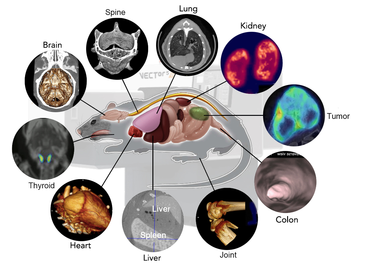 PET-SPECT-OI-CT imaging solution is expected to enable even more significant breakthroughs in anatomical, functional and molecular imaging