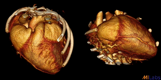 heart imaging 3D