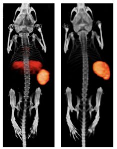Novel therapeutics for prostate cancer SPECT CT