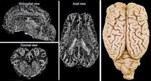 Yale Medical School BrainEx