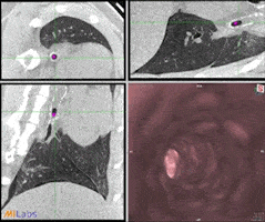 MILabs-Endoscopy-CT-Ferret_1_200px