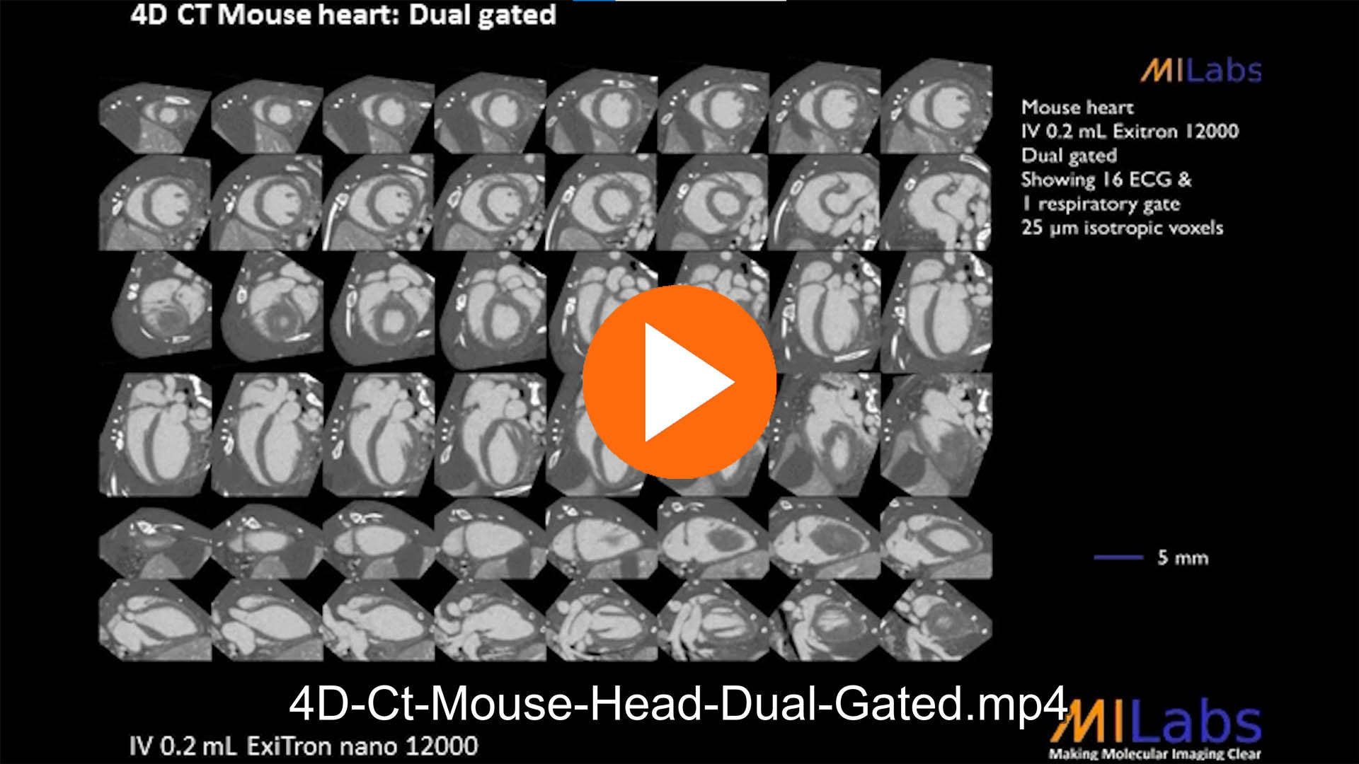 4D microCT mouse head dual gated
