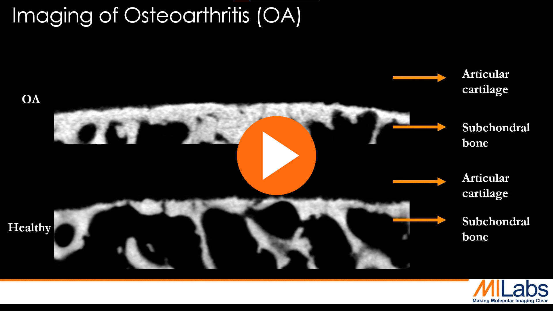 imaging of ostheoarthritis with microCT