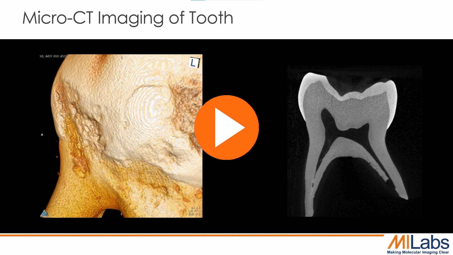 microCT imaging of a tooth dental imaging