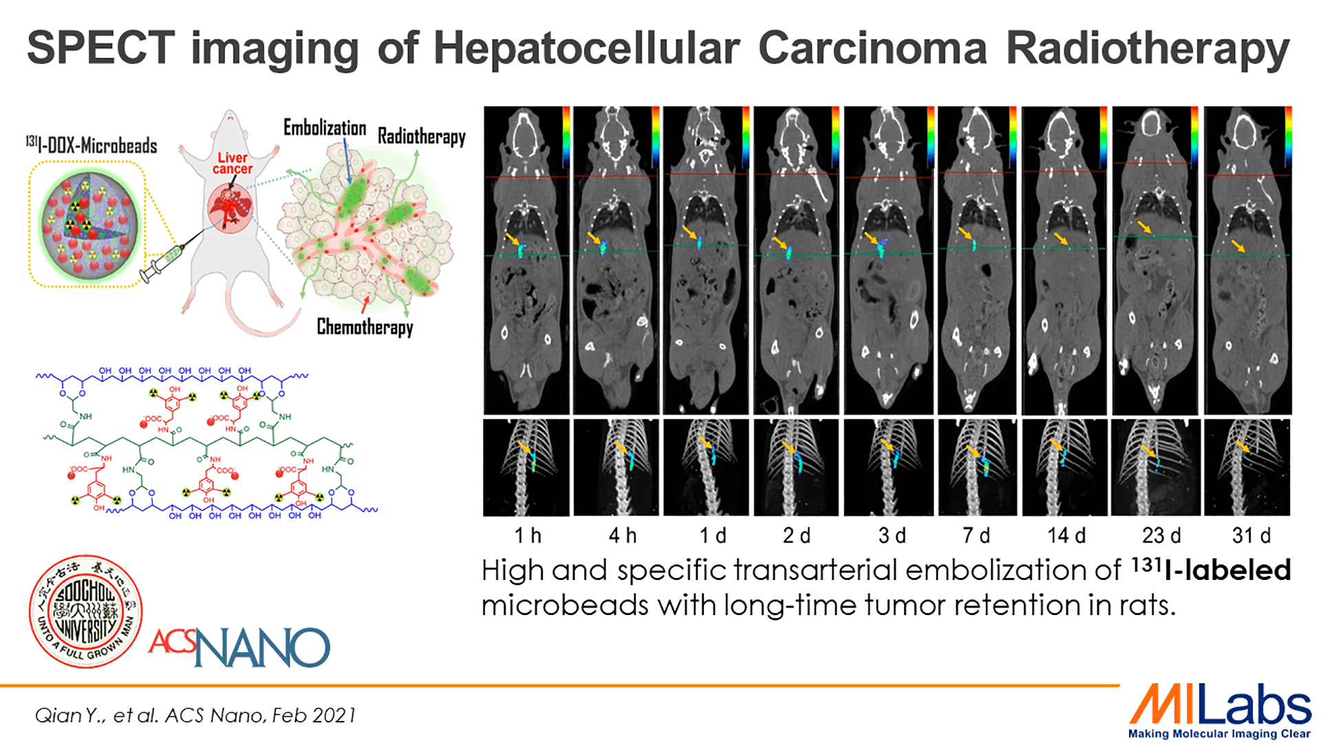 microSPECT imaging of Hepatocellular Carcinoma Radiotheraphy