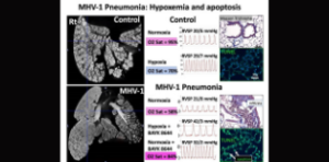 Imaging SARS-CoV-2 attacks mitochondria in cardiopulmonary cells in COVID-19 pneumonia