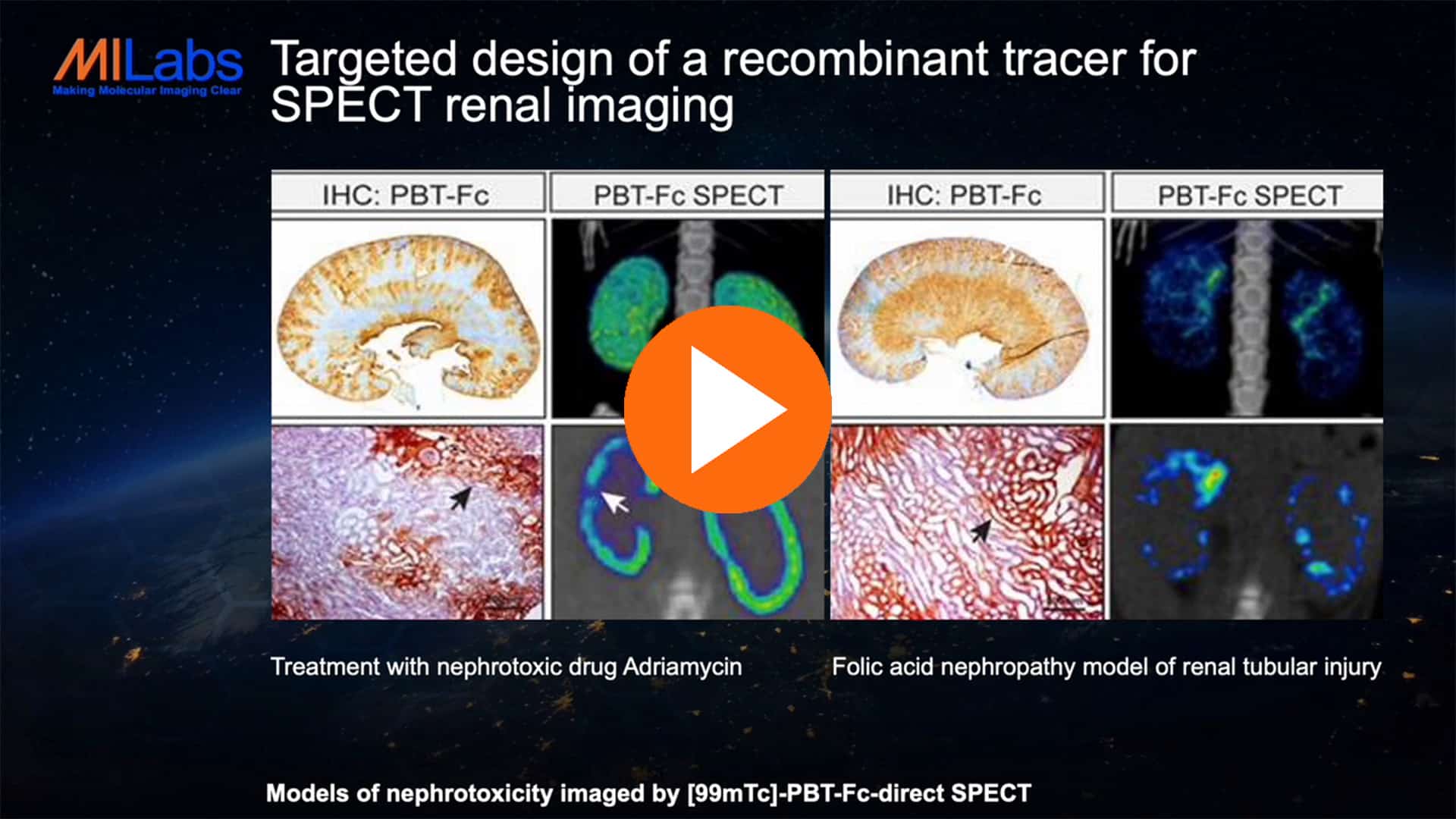 renal spect imaging