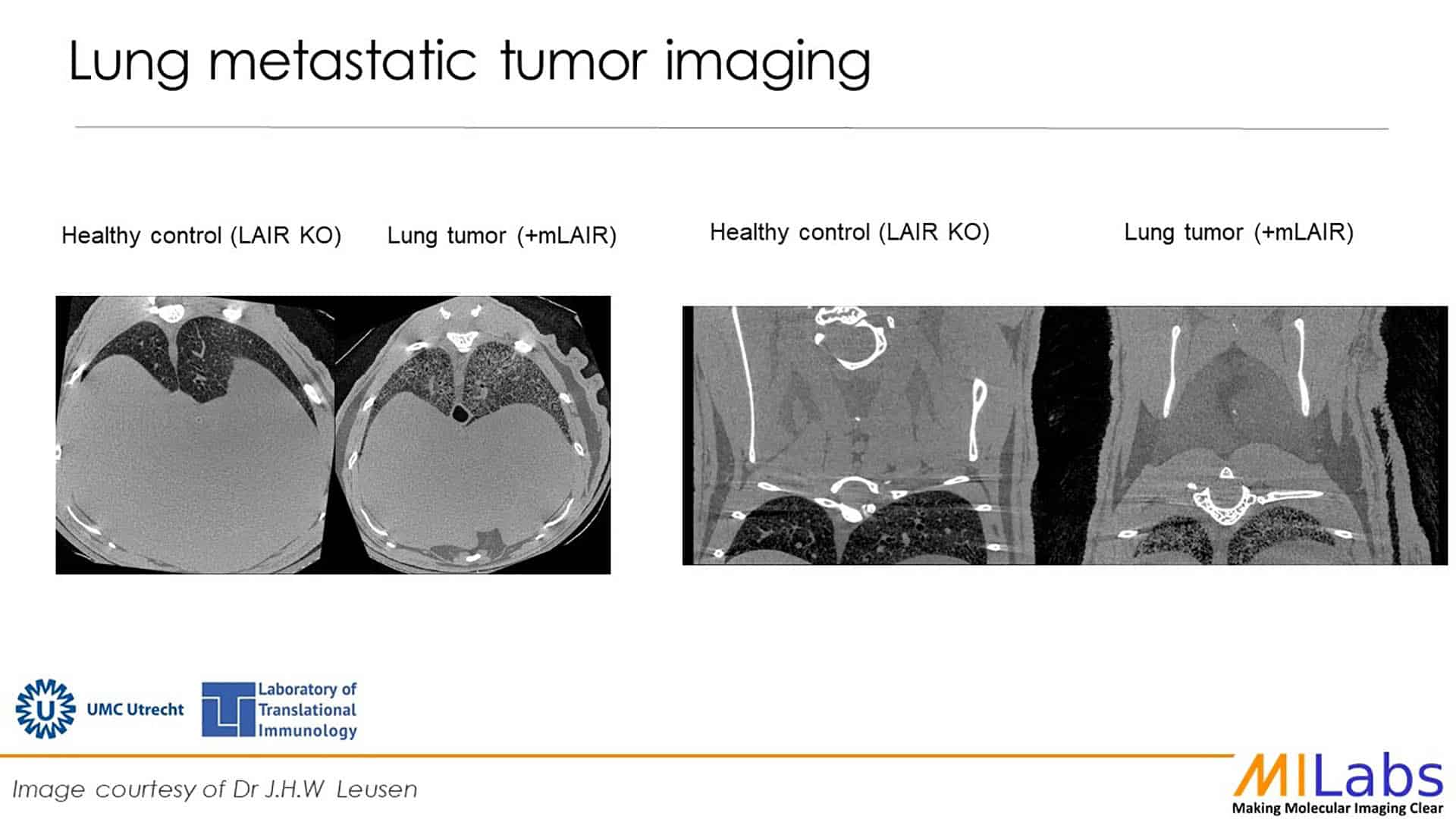 mouse metastatic tumor imaging