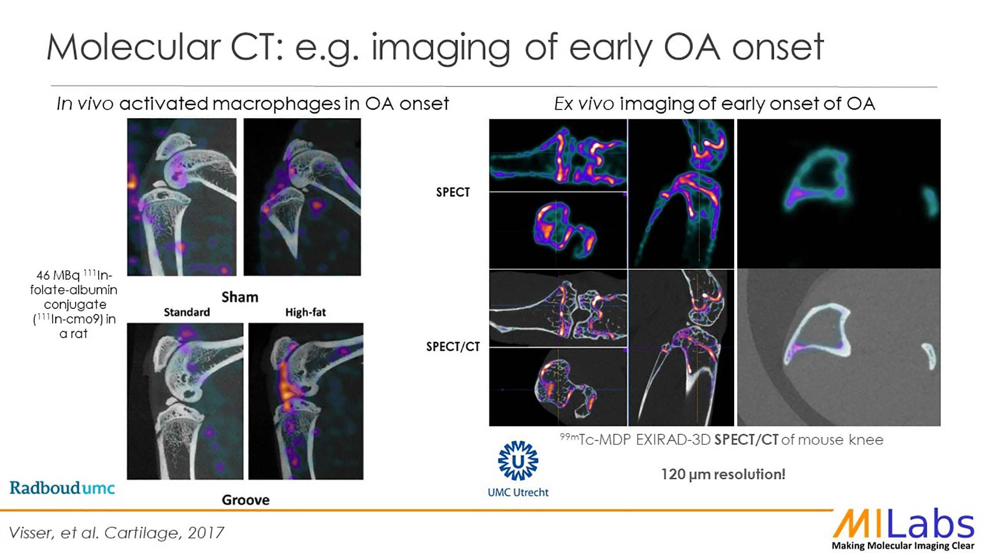 molecular CT imaging of early Osteoarthritis onset