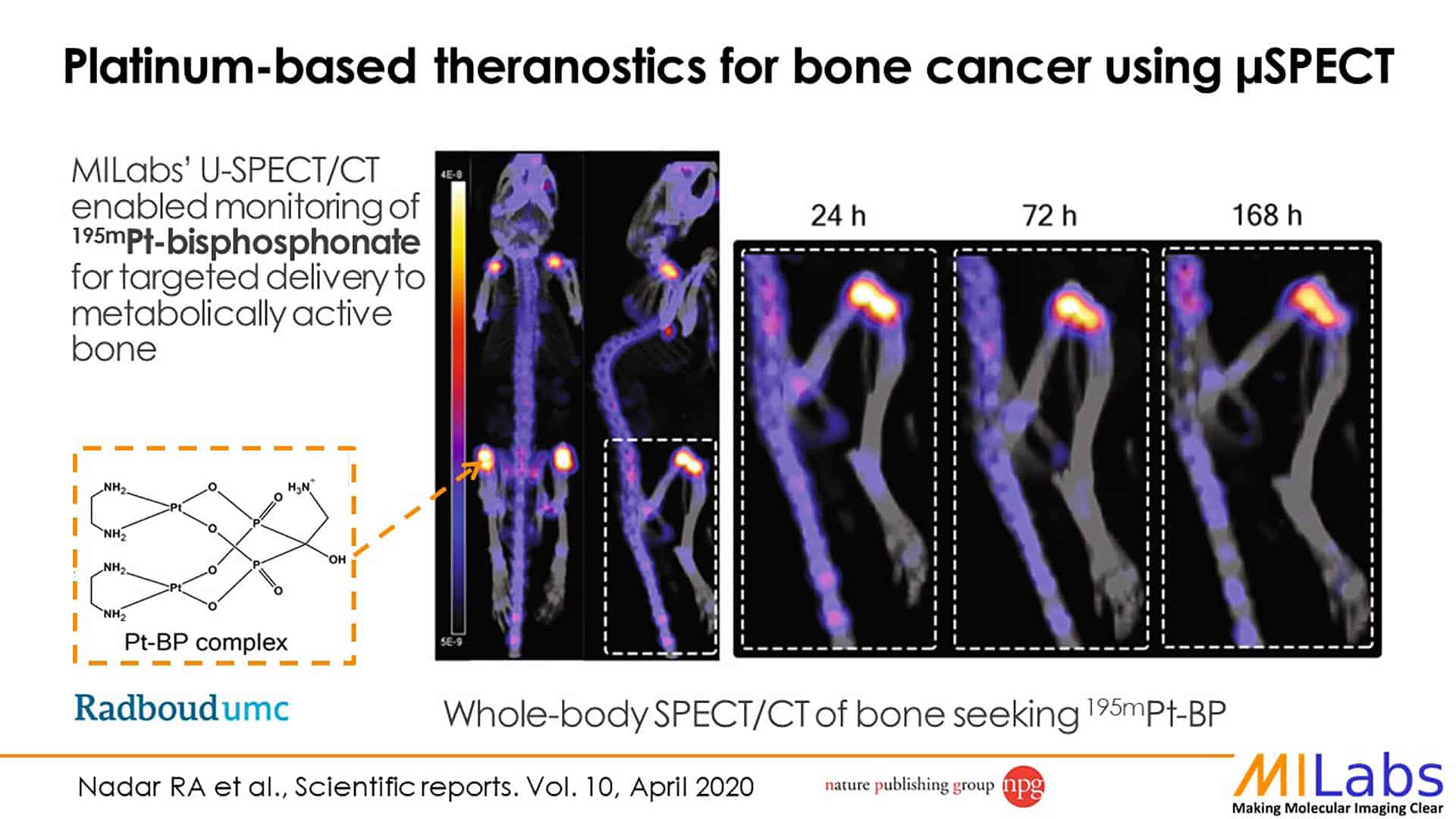 micro SPECT imaging of platinum based theranostics for bone cancer