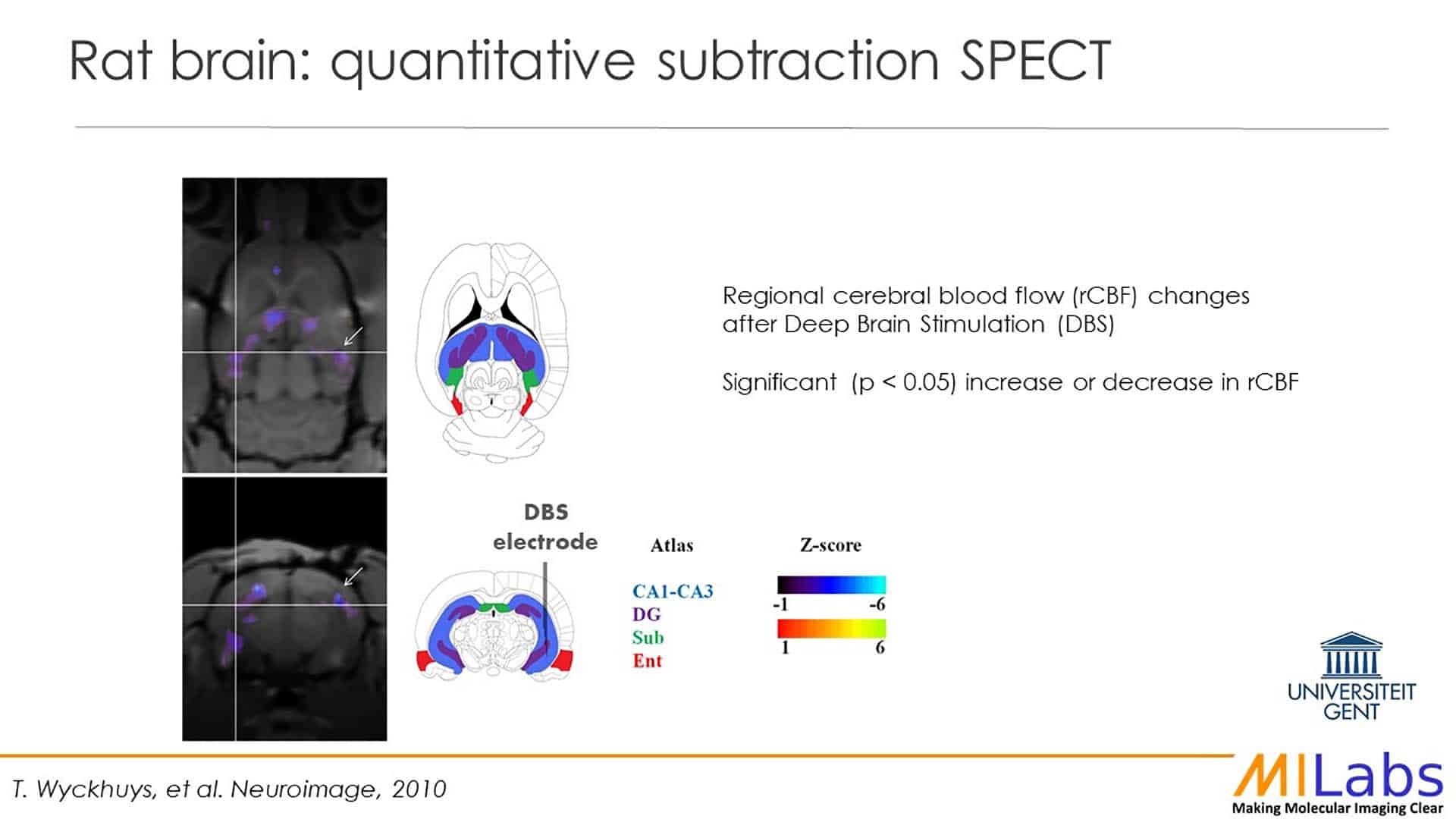 microSPECT imaging of rat brain quantitative substations