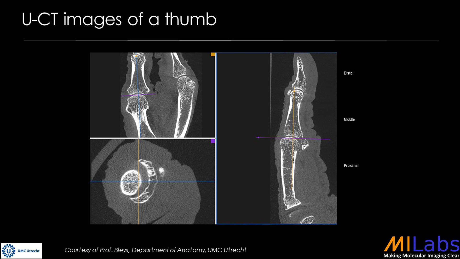 microCT imaging of a thumb