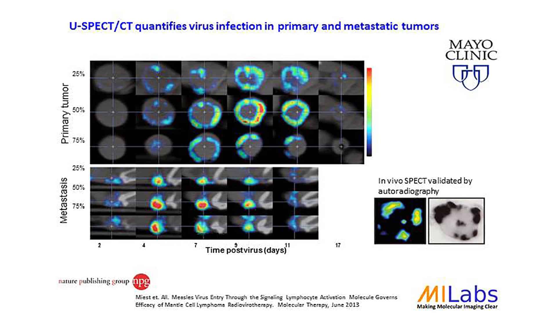 microSPECT/CT quantifies virus infection in primary and metastatic tumors