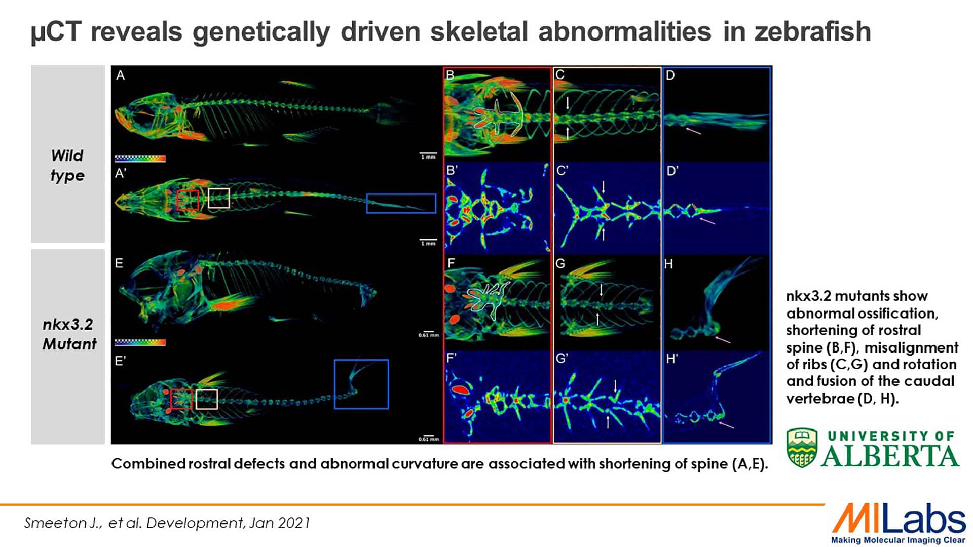 microCT genetically driven skeletal abnormalities in zebrafish